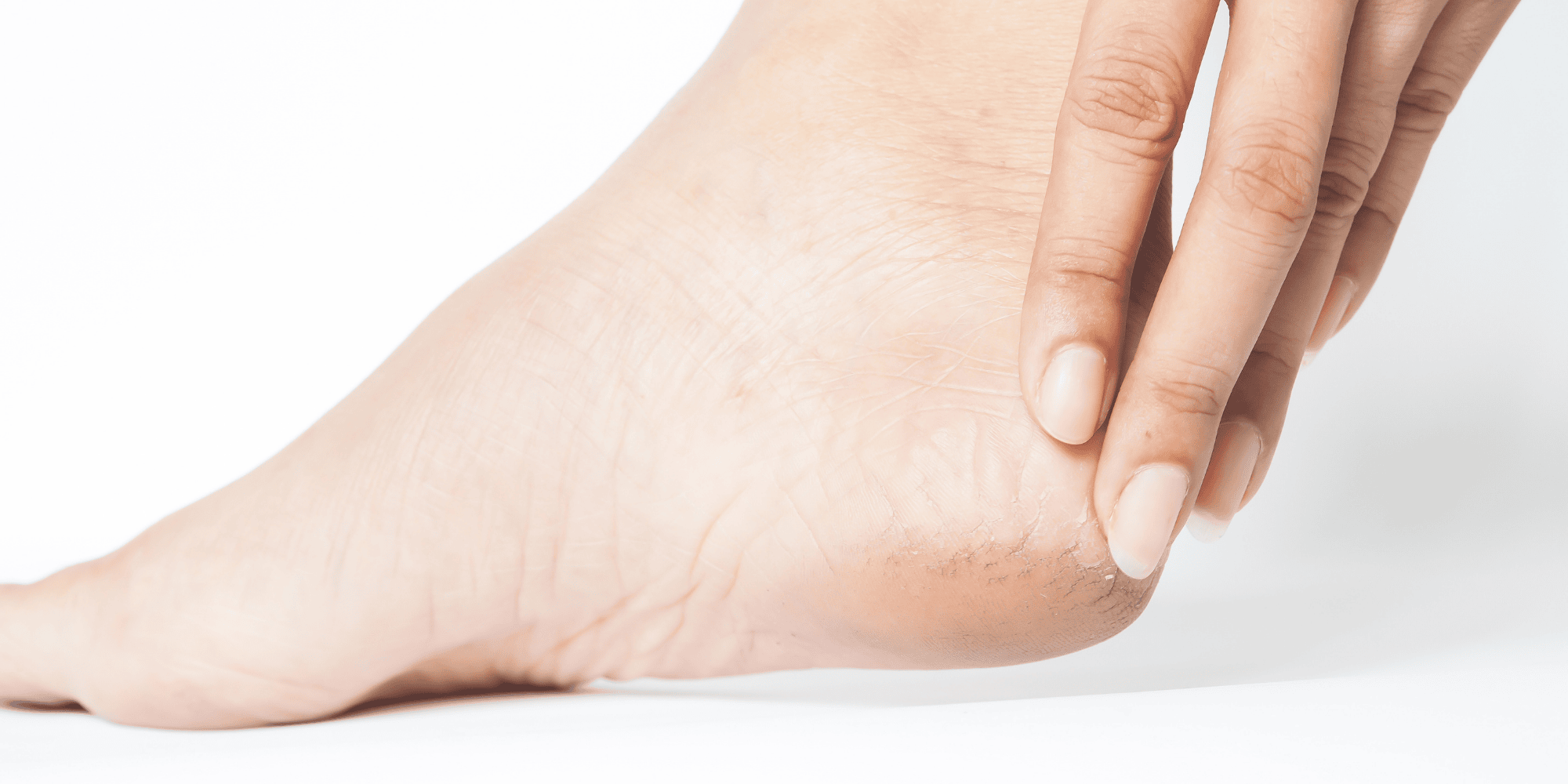 Topuk Dikeninde Kemikleşme (Kalsifikasyon) Süreci Nasıl İşler? Anatomik Yanıtın Detaylı İncelenmesi