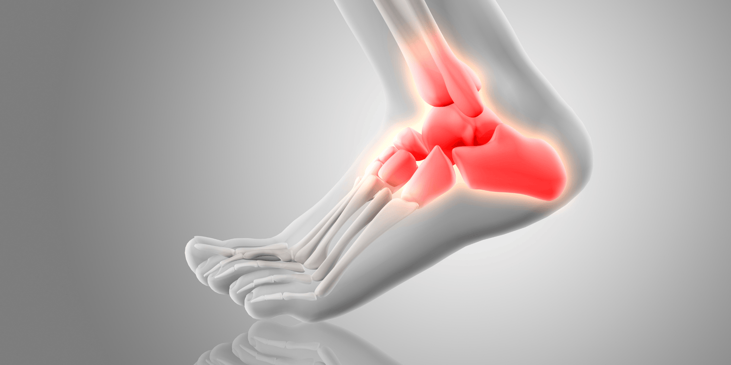 Topuk Dikeni Nasıl Görünür?