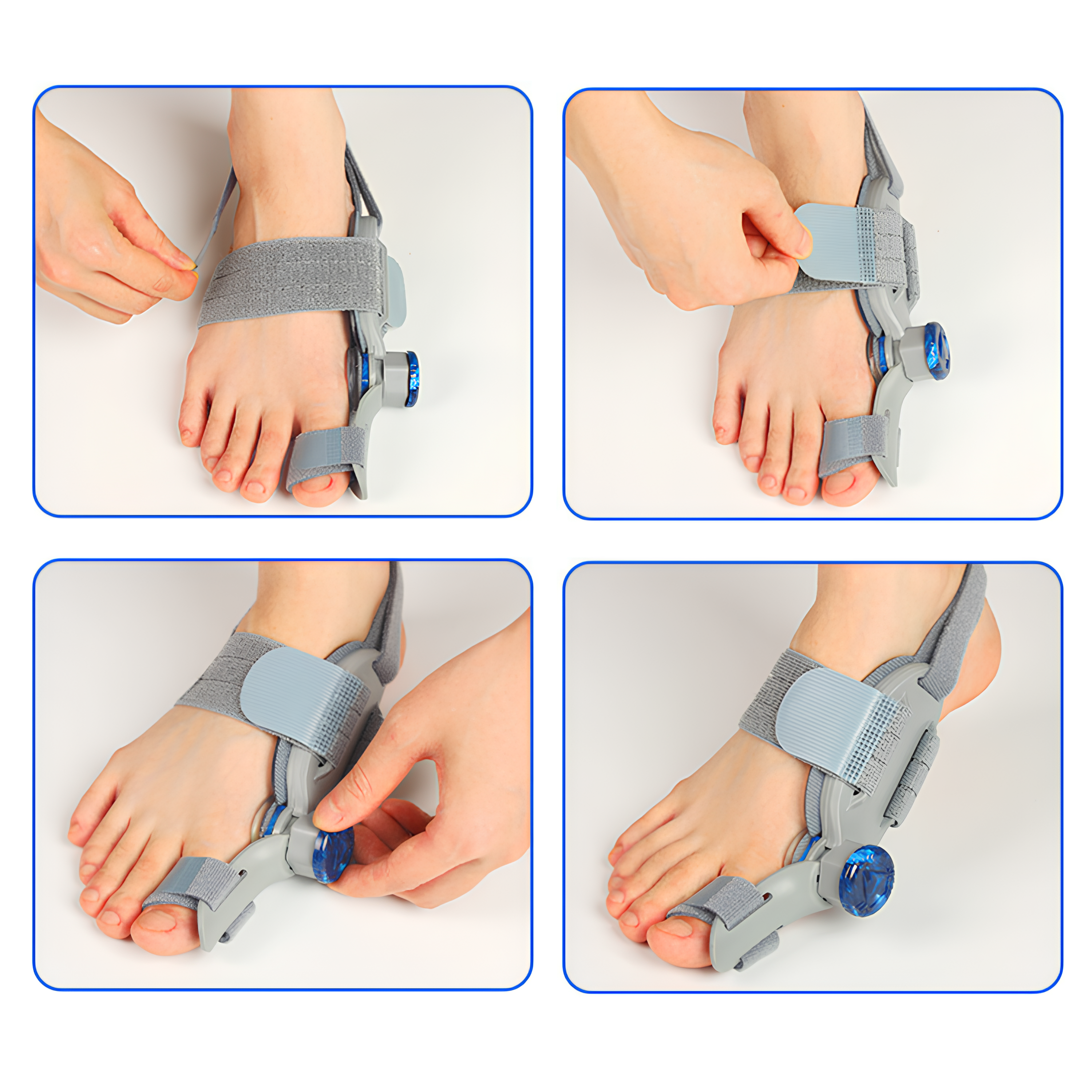 LUCİSUMBRA HALLUX VALGUS DÜZELTİCİ