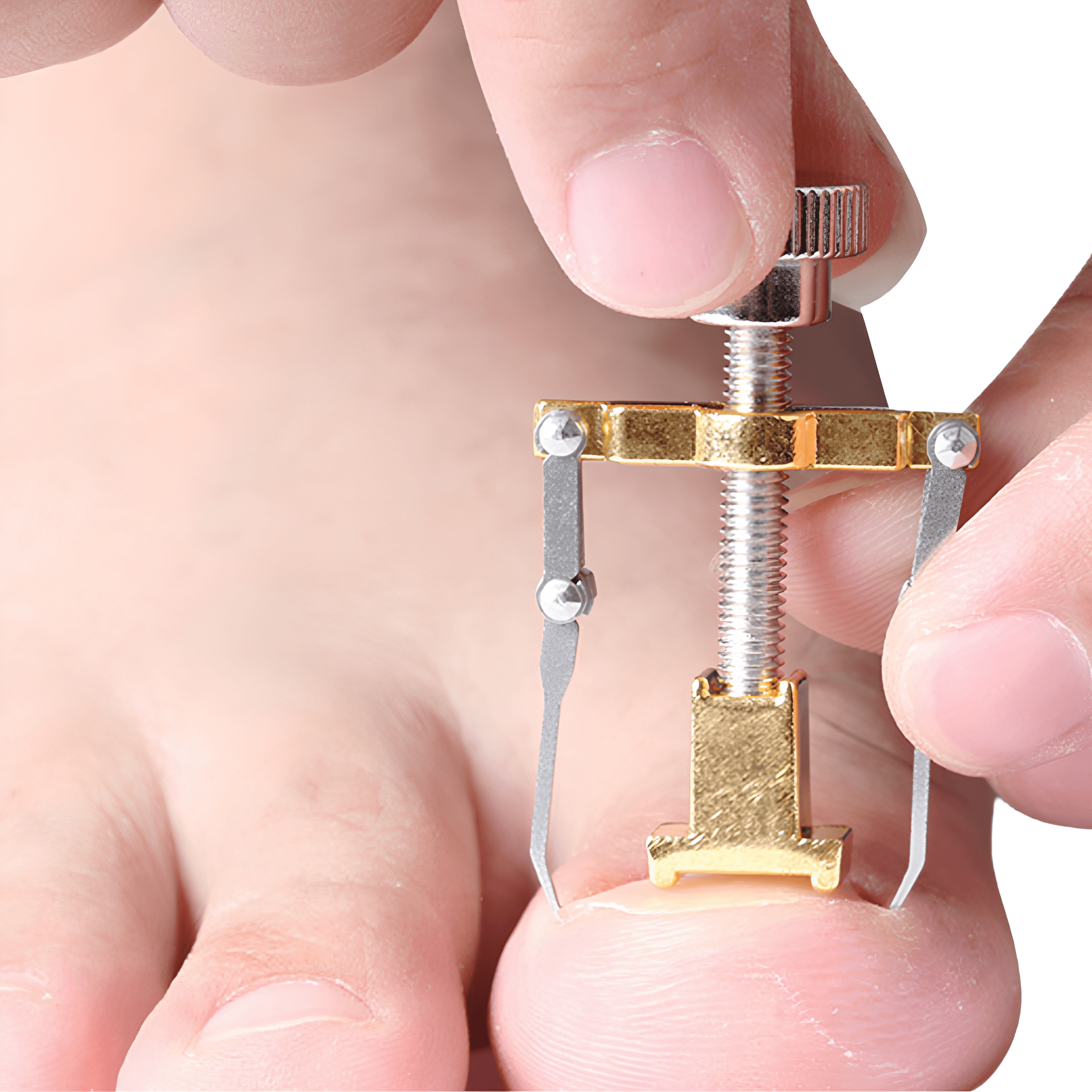 Batık Tırnak Düzeltici - Gri | Lucisumbra