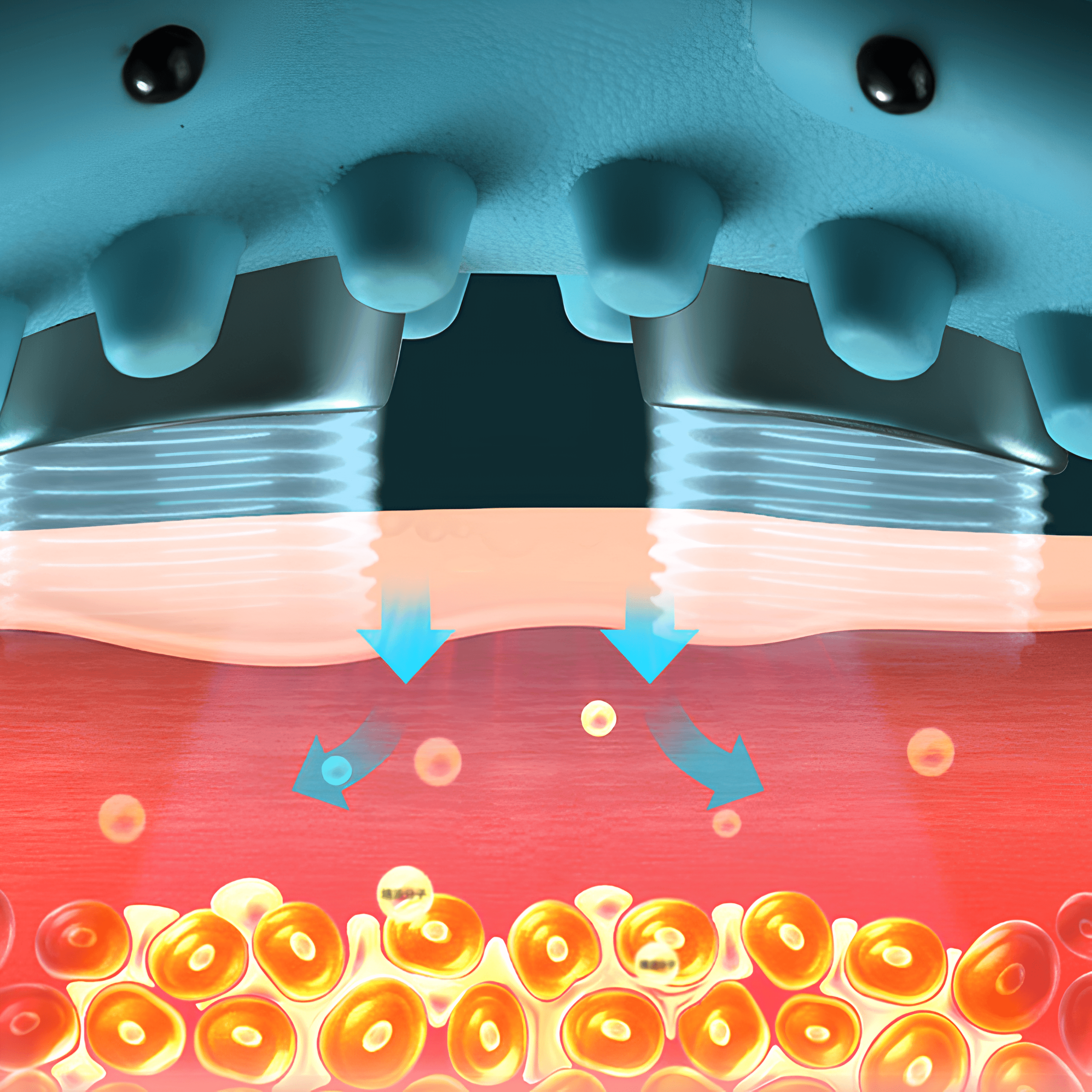 Kulunç Masaj Aleti - Boyun Fıtığı İçin, Mavi | Lucisumbra