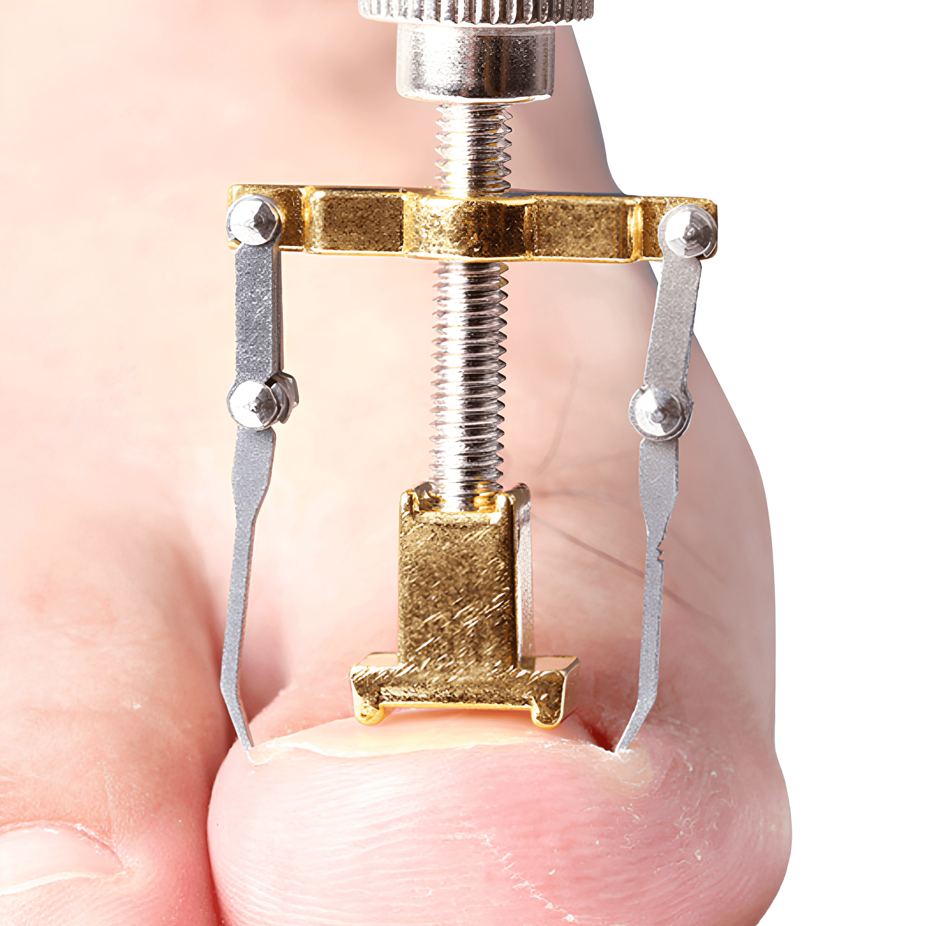 Batık Tırnak Düzeltici - Gri | Lucisumbra