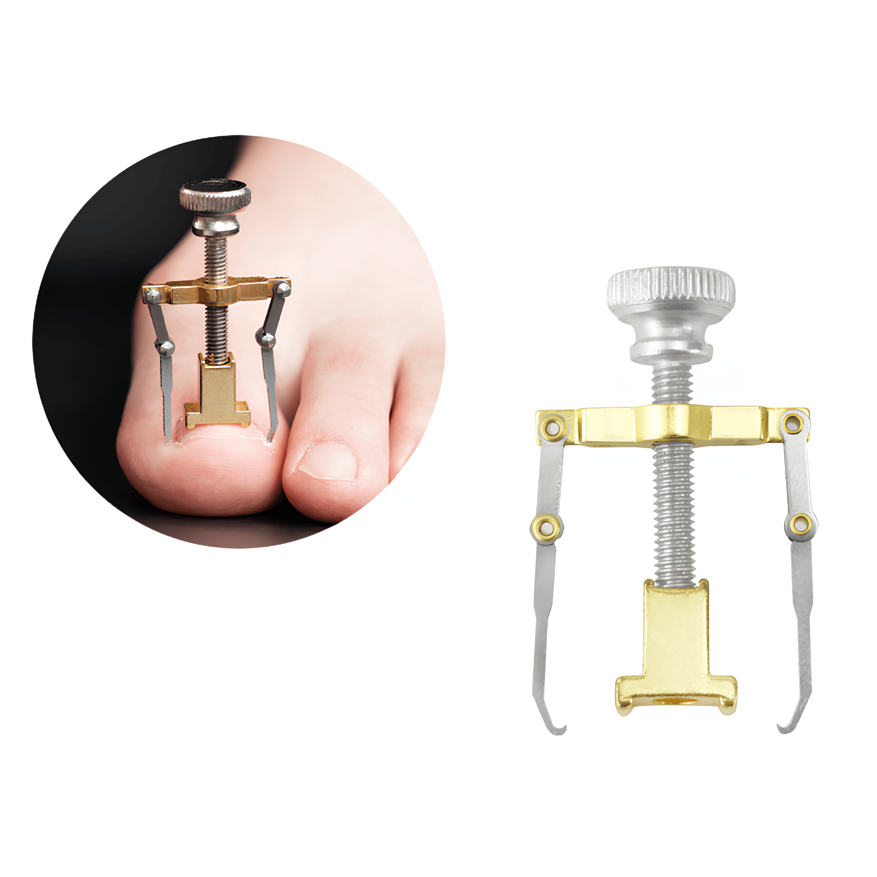 Batık Tırnak Düzeltici - Gri | Lucisumbra