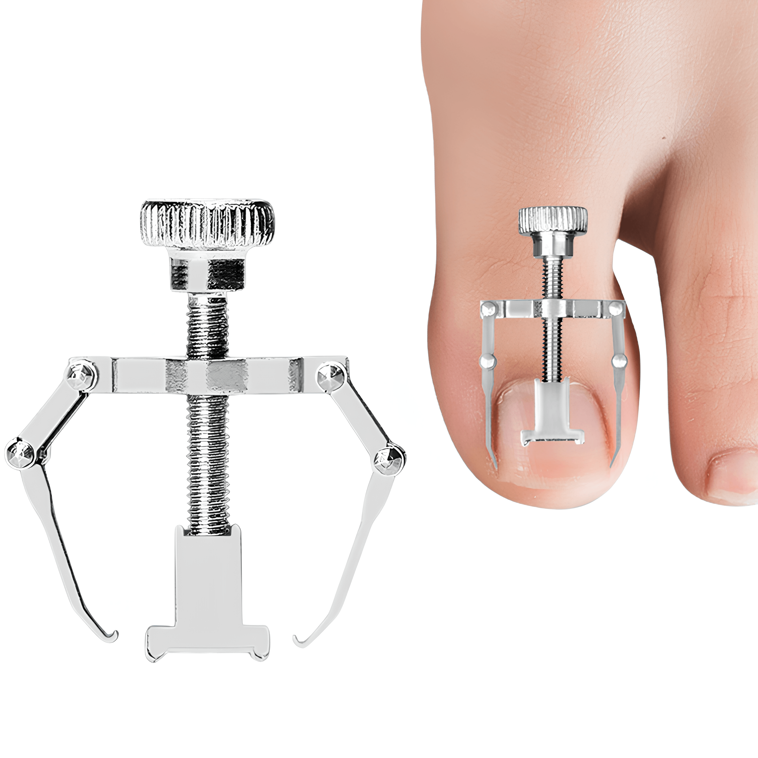 Batık Tırnak Düzeltici - Gri | Lucisumbra