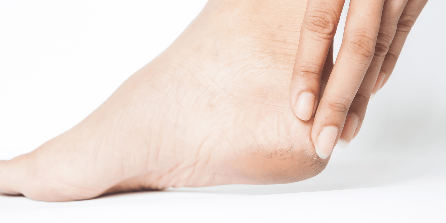 Topuk Dikeni Neden Olur?