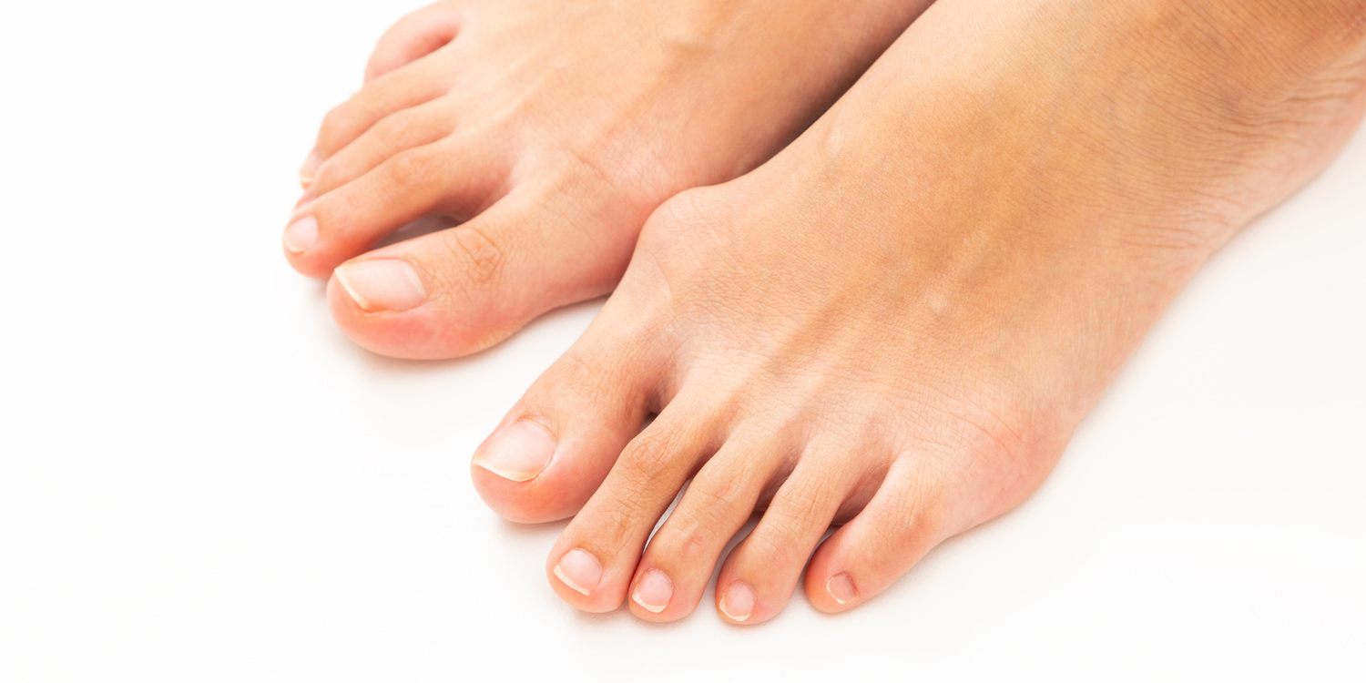 Gece Atelleri ile Baş Parmak Çıkıntısı Tedavisi