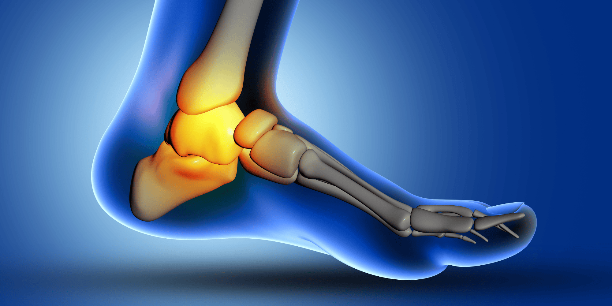 Topuk Dikeni Ve Plantar Fasiit Aynı Şeymi? Bilinmesi Gereken Tanı ve Tedavi Farkları