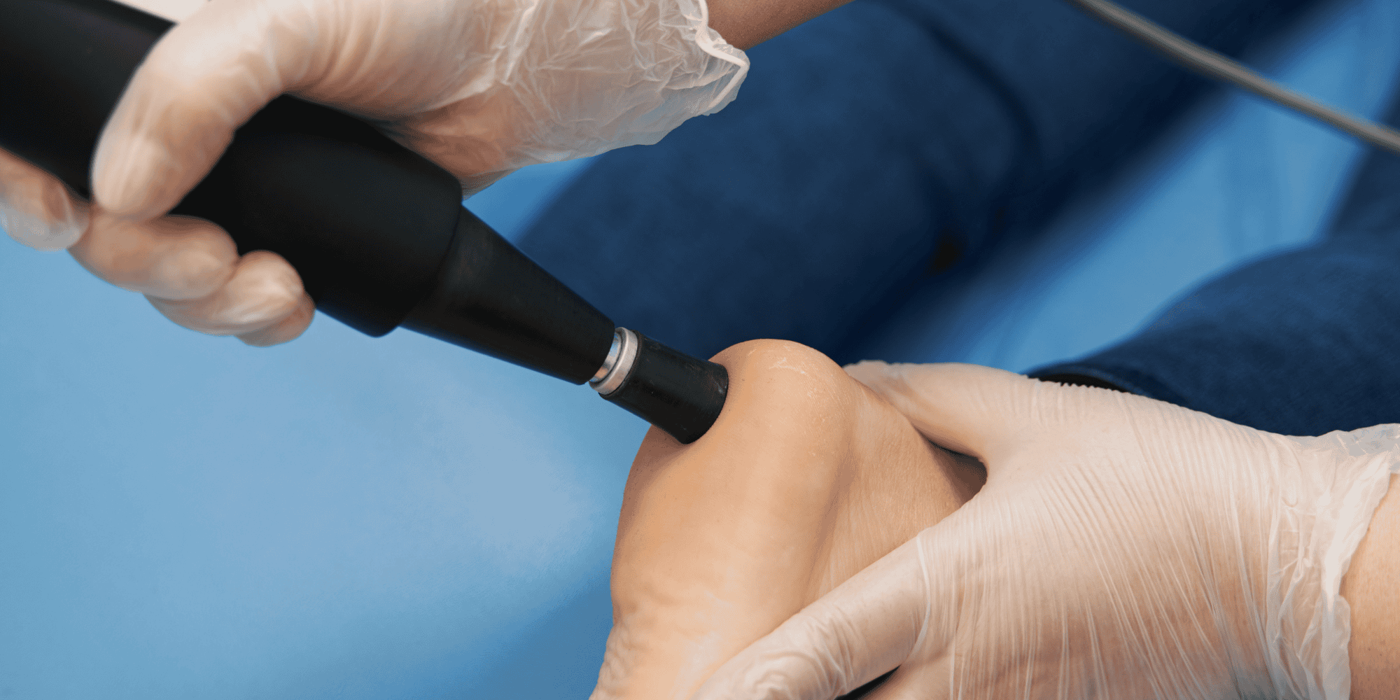 Eswt (Şok Dalga Tevavisi) Nedir? Tendon ve Kas Ağrılarında Devrim Yaratan Non-İnvaziv Yöntem